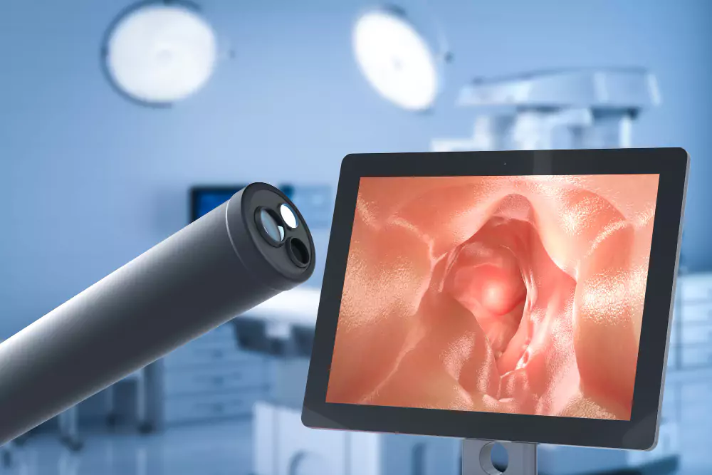Diagnostic & Therapeutic Endoscopy