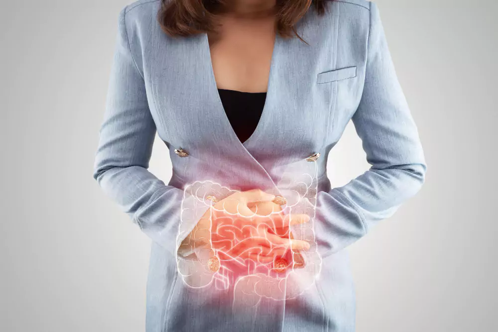 Inflammatory Bowel Disease (IBD) Management